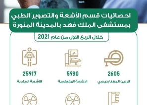 إجراء أكثر من 39 ألف فحص تشخيصي بالأشعة بمستشفى الملك فهد بالمدينة المنورة