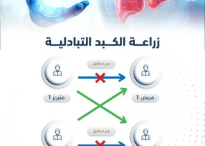 في عملية تعد الأولى من نوعها في الشرق الأوسط نجاح أول زراعة كبد تبادلية في تخصصي الدمام