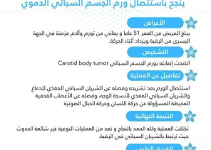 فريق جراحة الرأس والرقبة بمستشفى الأمير محمد بن ناصر بجازان ينجح في استئصال ورم الجسم السباتي الدموي