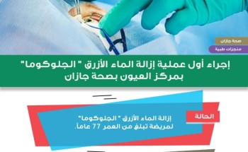 إجراء أول عملية إزالة الماء الأزرق “الجلوكوما” بمركز العيون بصحة جازان