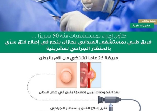 فريق طبي بمستشفى العيدابي ينجح في اصلاح فتق سرّي بالمنظار الجراحي لعشرينية بجازان