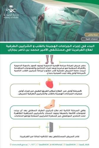 البدء في إجراء الجراحات الهجينة للقلب والشرايين الطرفية لعلاج الغرغرينا في مستشفى الأمير محمد بن ناصر بجازان