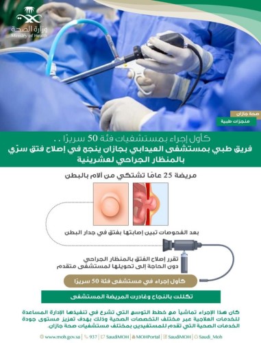 فريق طبي بمستشفى العيدابي ينجح في اصلاح فتق سرّي بالمنظار الجراحي لعشرينية بجازان